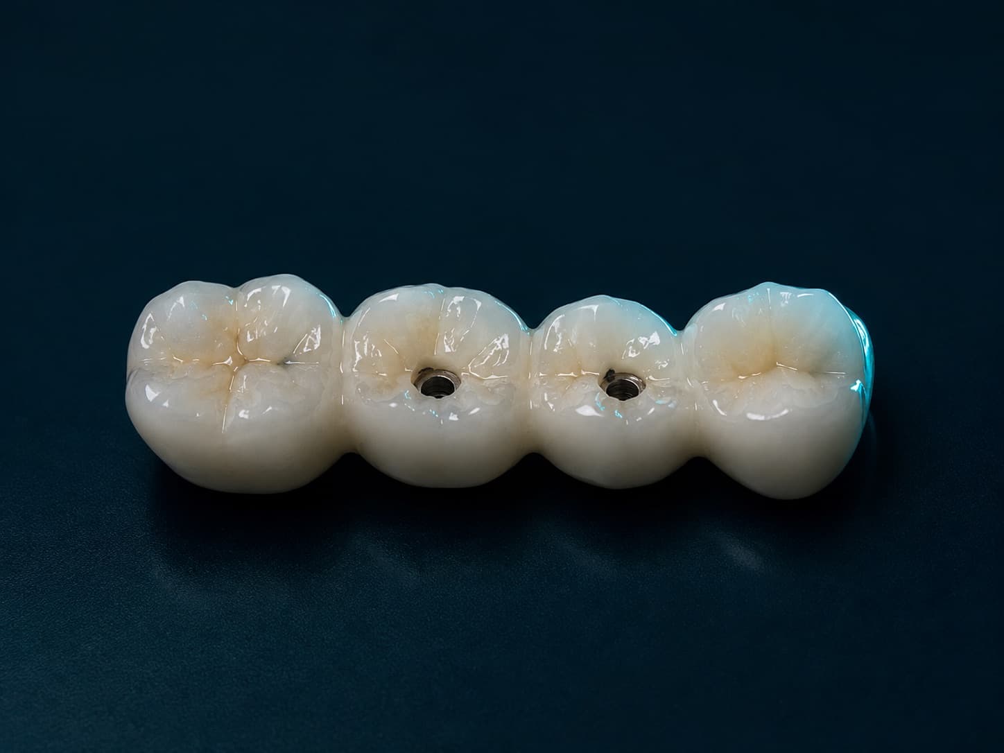 Viergliedrige verschraubte Implantatbrücke liegend, zwei Schraubenkanäle sichtbar.