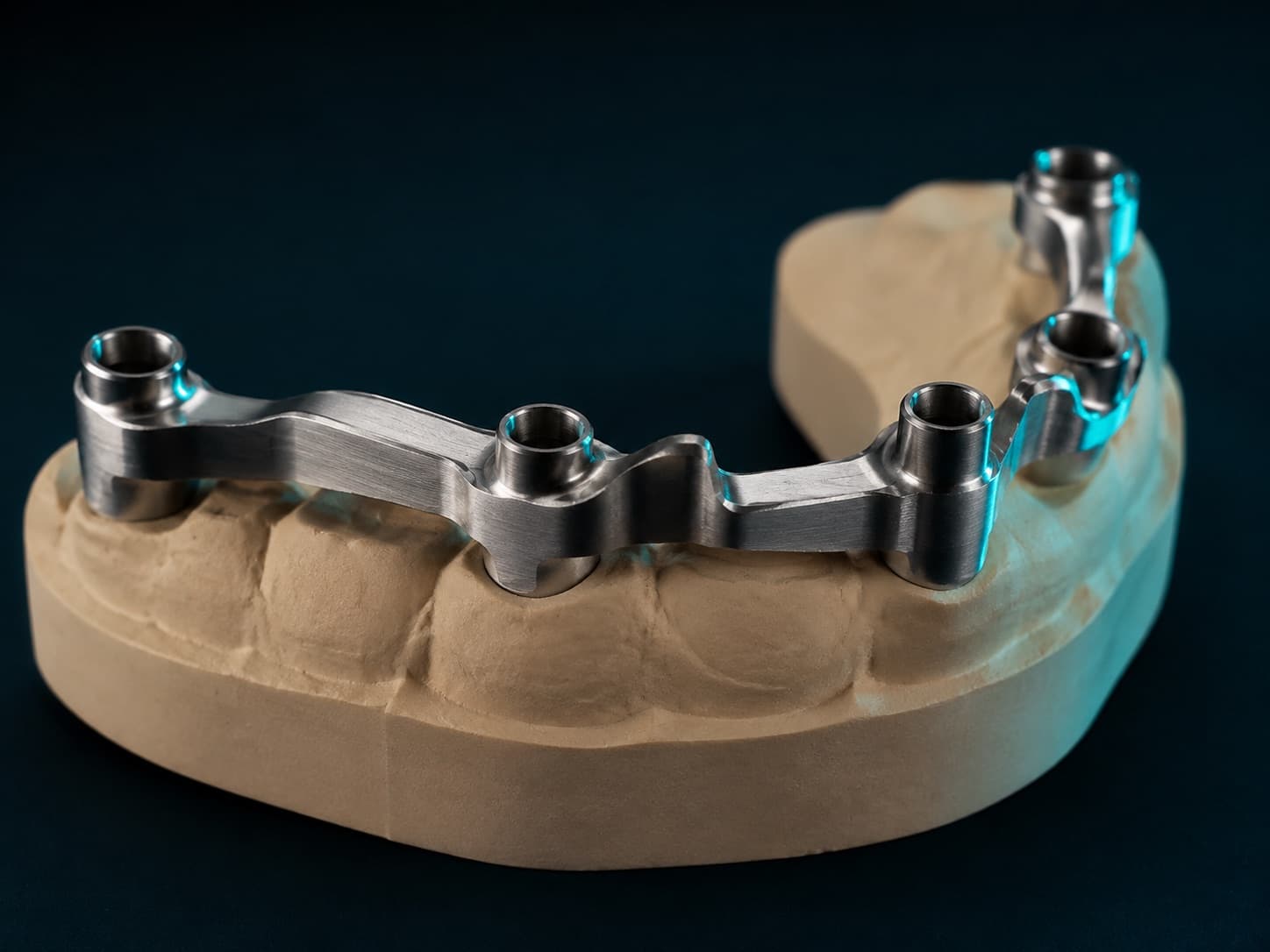 Gefräster Steg über mehreren Implantatpfeilern auf einem Modellsegment.