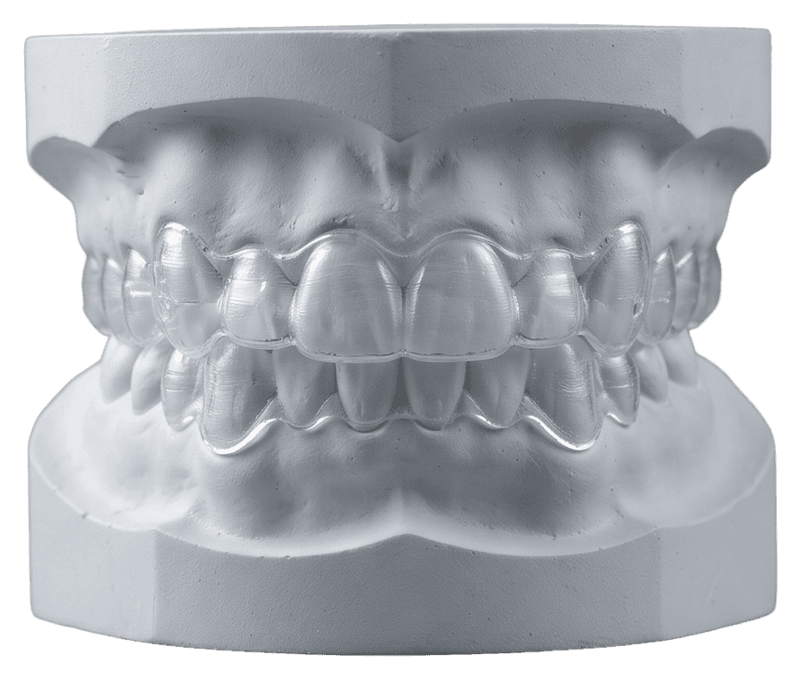Schienen & Aligner